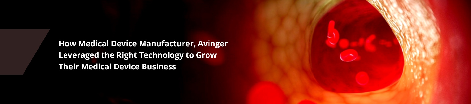 avinger-offer-header-image-1.jpg